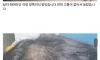25살 대머리 모발이식 후기