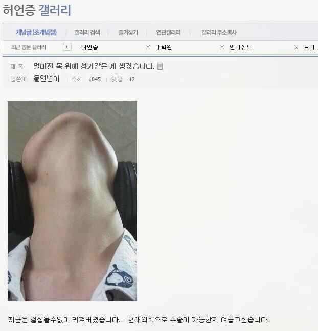 허언증 갤러리