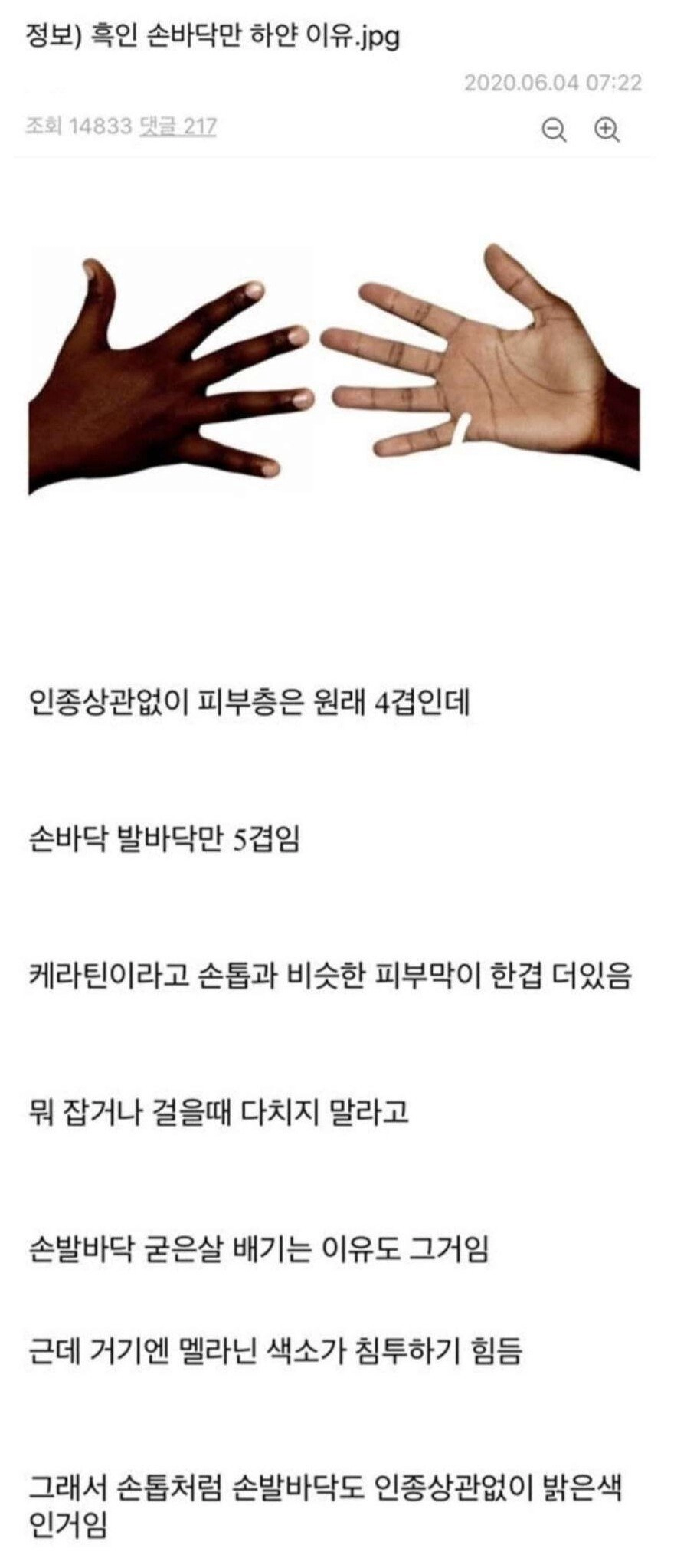 흑인 손바닥만 하얀 이유.jpg