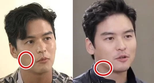 이장우로 보는 다이어트 중요성.jpg