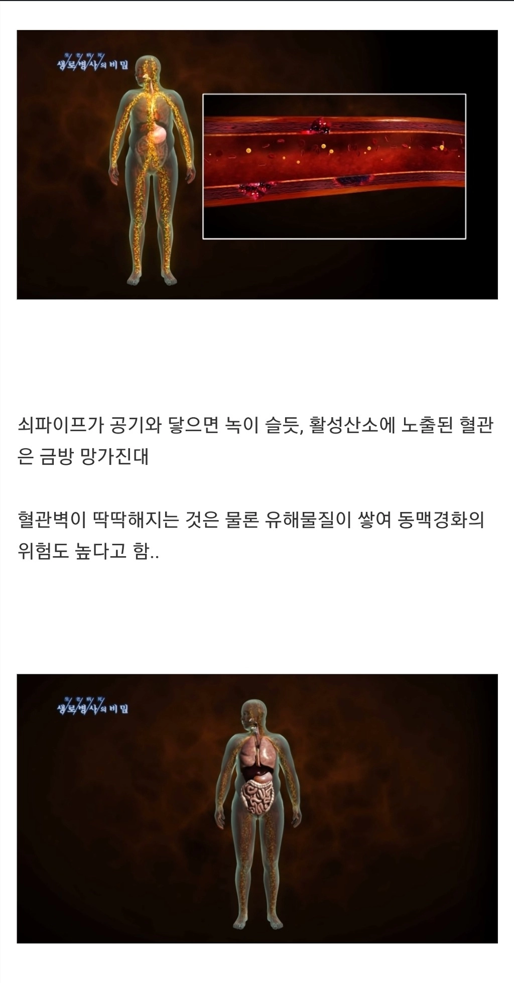 과식하면 빨리늙고 빨리죽는 이유