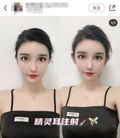 중국 20대 여자들 사이에서 유행하는 성형 스타일