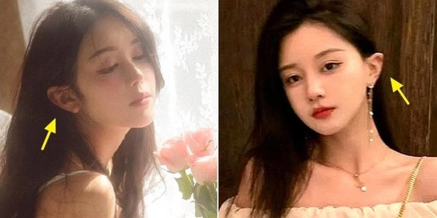 중국 20대 여자들 사이에서 유행하는 성형 스타일