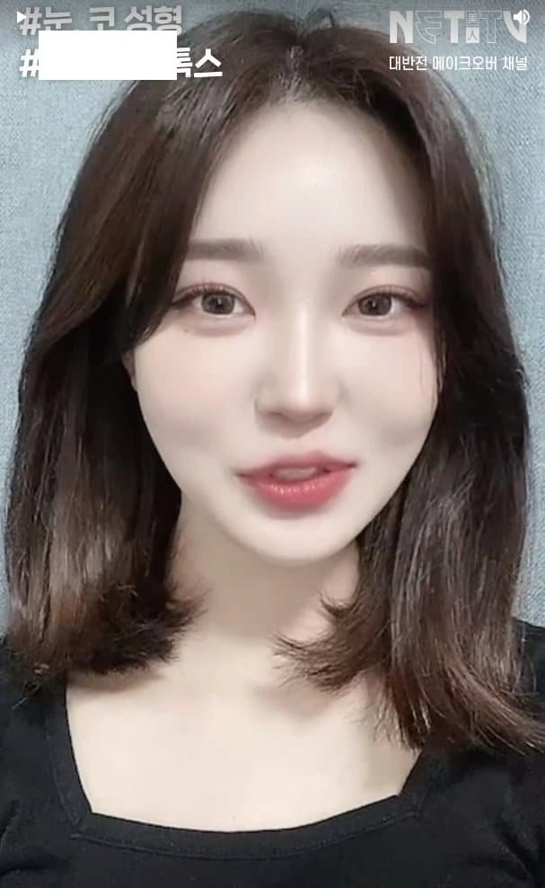 흔한 한국여자의 성형수술 전후사진 ㄷㄷ