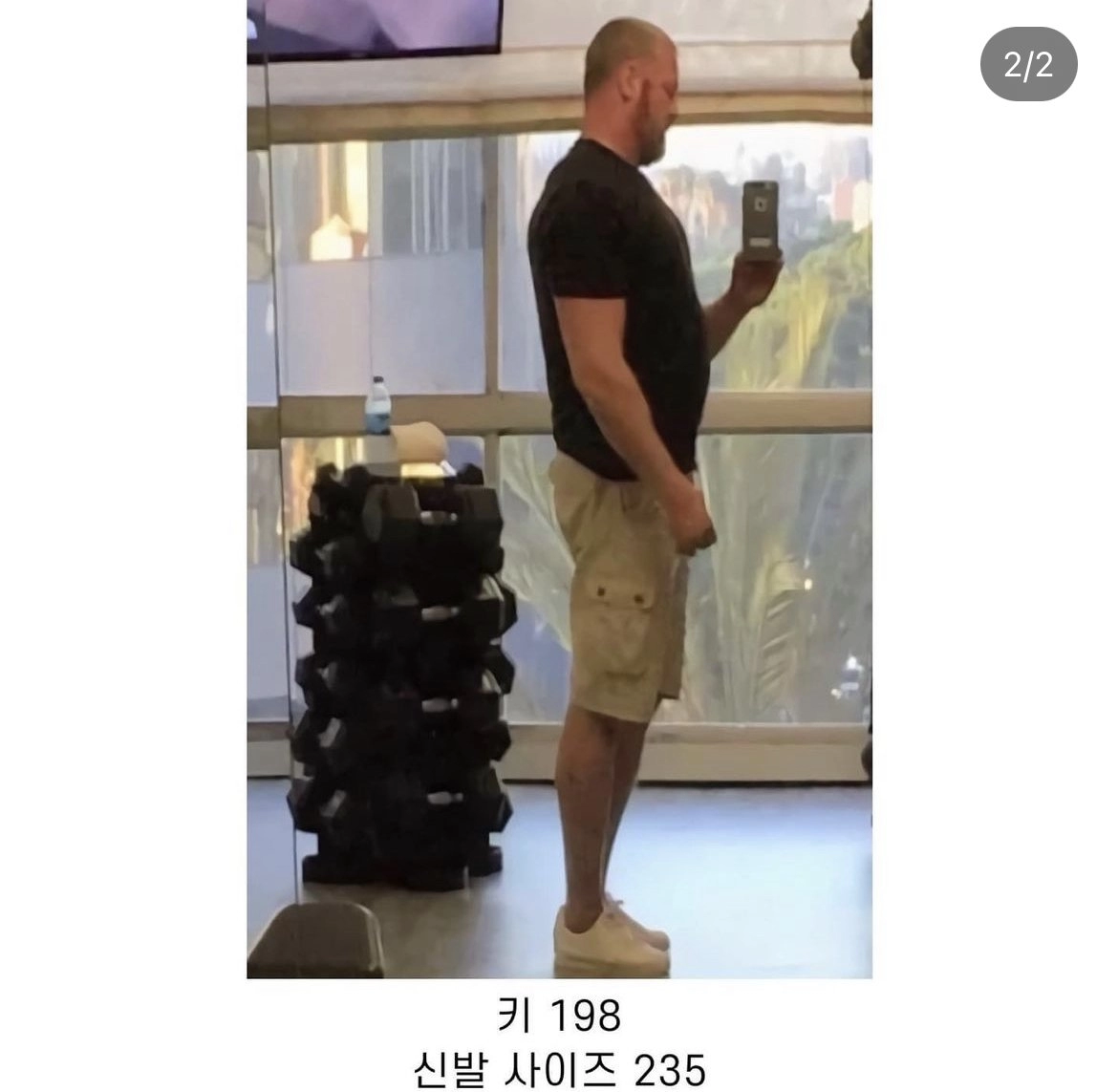 특인한 신체구조 때문에 놀림받는 사람