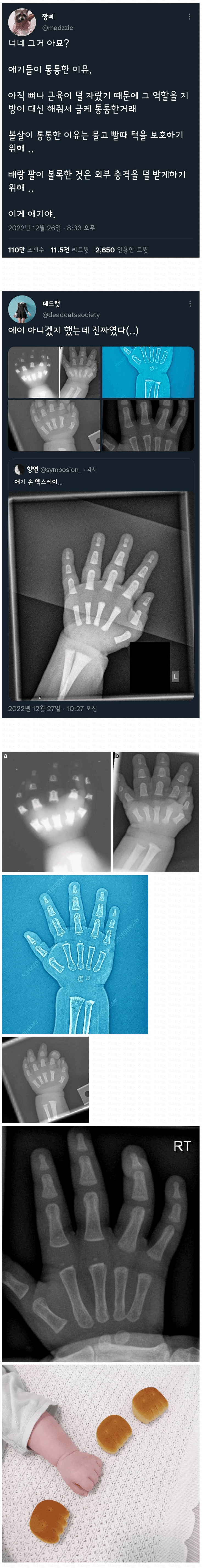 애기 손이 통통한 이유.