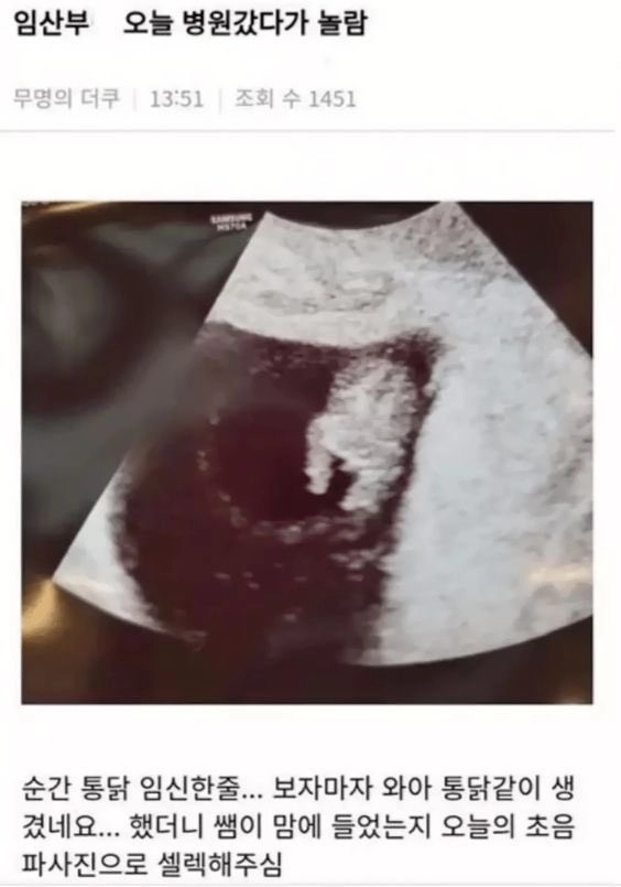 통닭을 임신한 여성