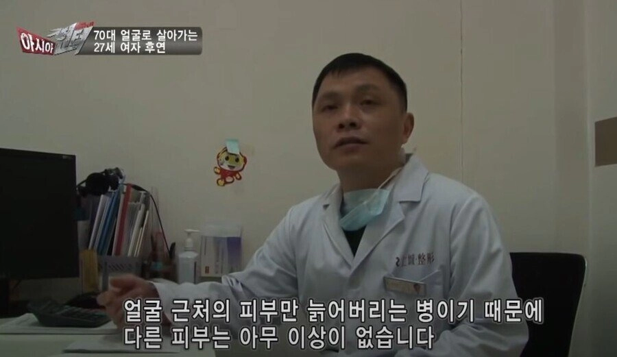 실제 나이는 20대인데 70대 얼굴로 살아가는 여자