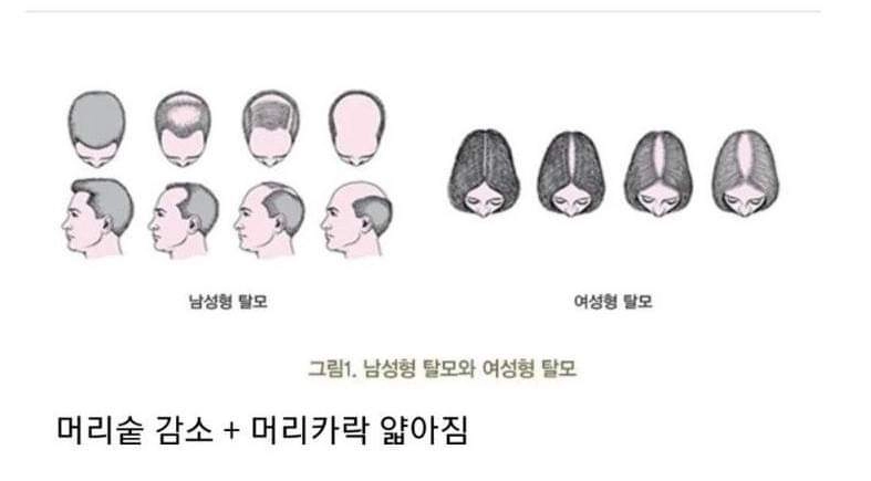 방심하면 확 늘어버린다는 30대