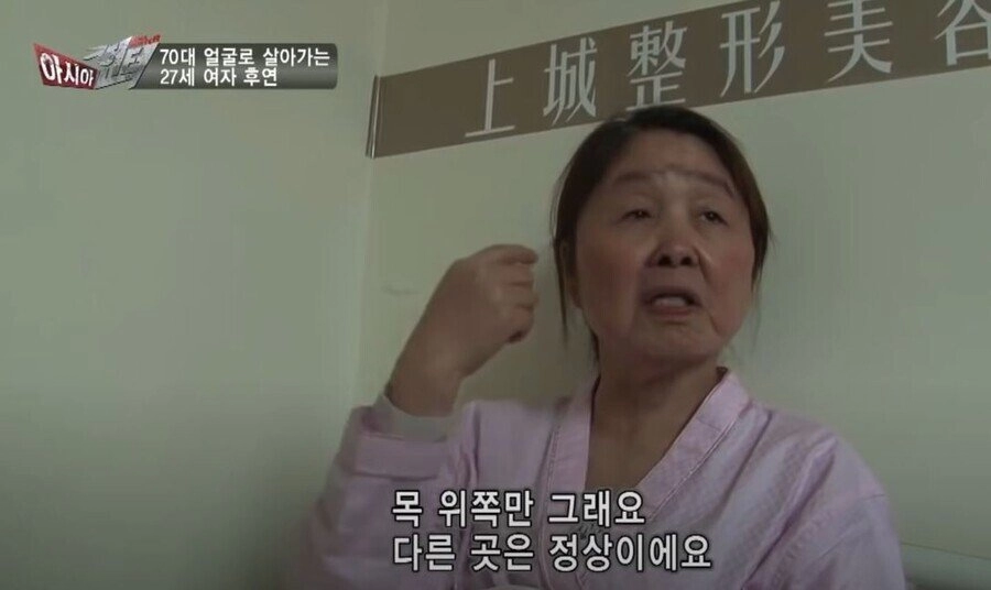 실제 나이는 20대인데 70대 얼굴로 살아가는 여자