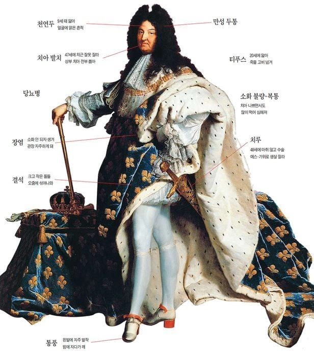 저주받은 다이아몬드를 이겨낸 왕