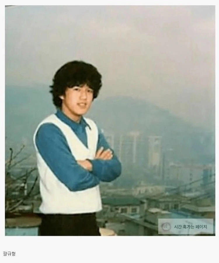 20대 때 숱 많다고 안심하면 안되는 이유