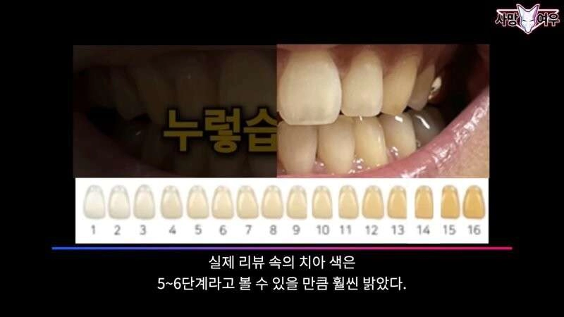 미백 치약 허위 광고 고발한 사망여우