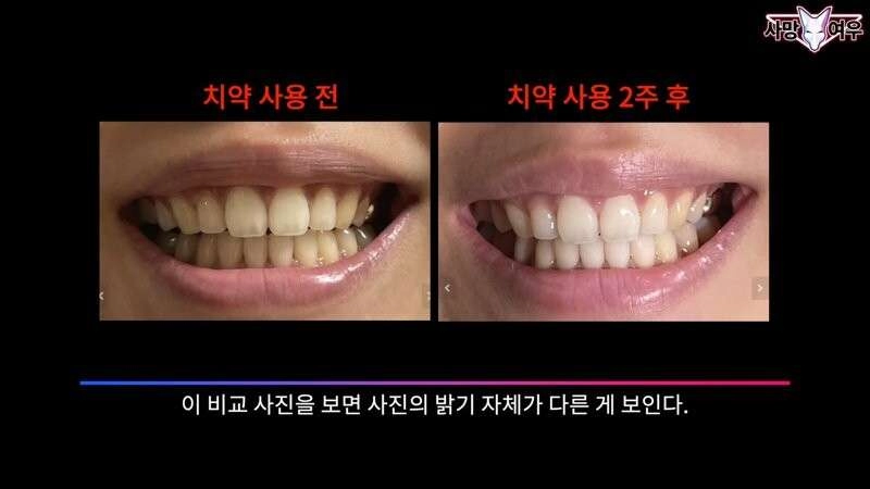 미백 치약 허위 광고 고발한 사망여우