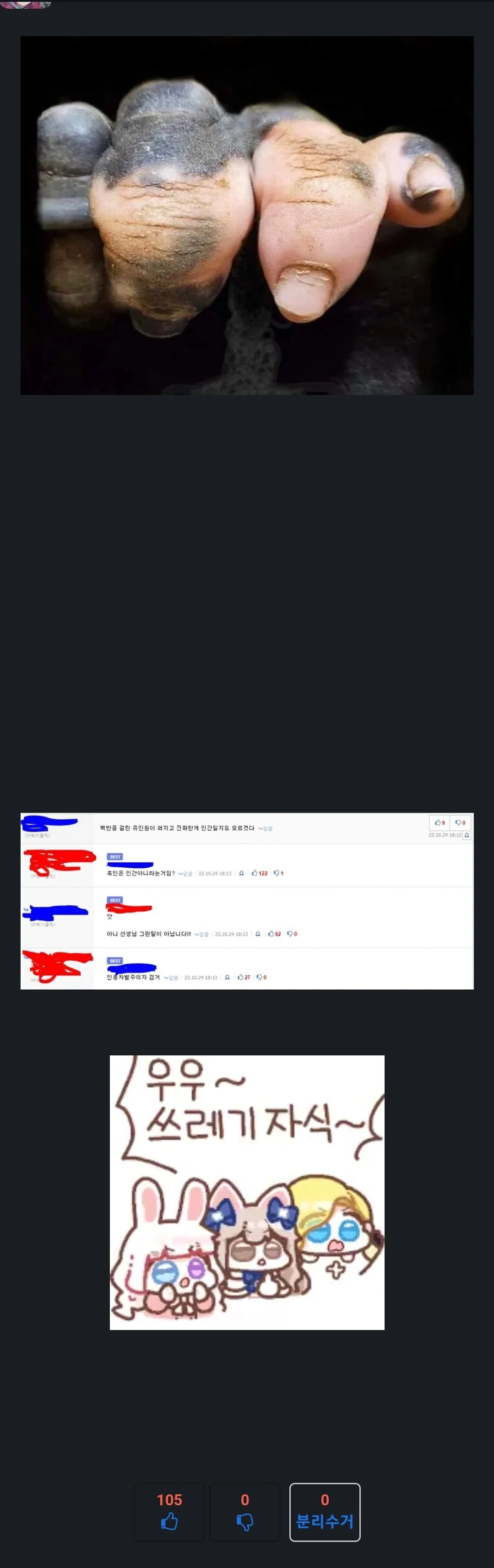 백반증 걸린 고릴라의 손