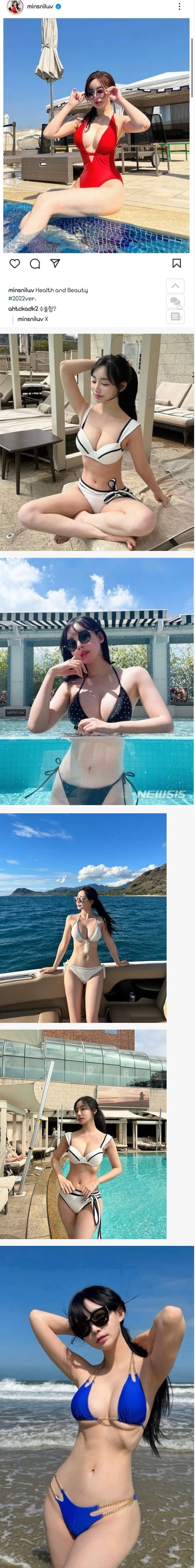 본인피셜 노수술 자연산이라는 곽ㅁ선