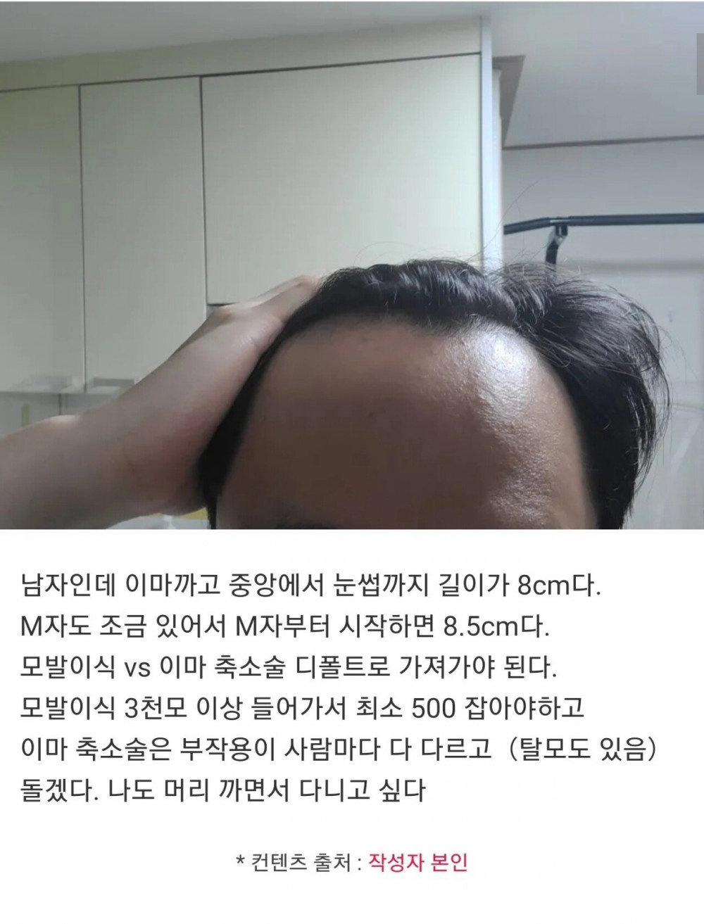 이마 8cm다 자괴감 든다
