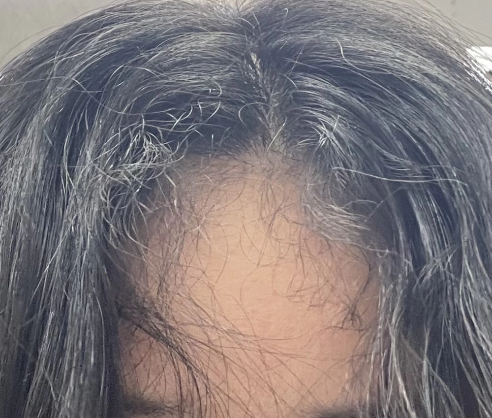 이런 곱슬 가진 사람 은근 있음