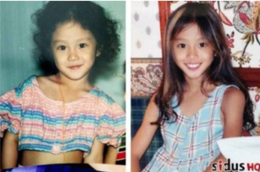 성형하고 싶었지만 아버지가 반대했다는 여자 연예인