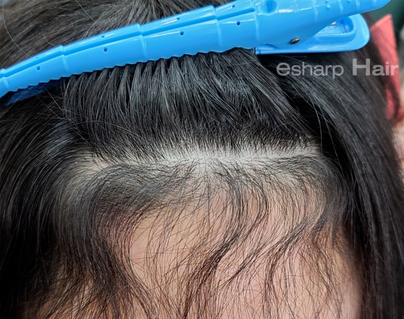 이런 곱슬 가진 사람 은근 있음