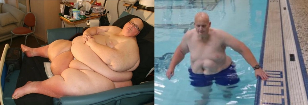 몸무게의 절반 이상을 뺀 세계에서 가장 뚱뚱했던 사나이