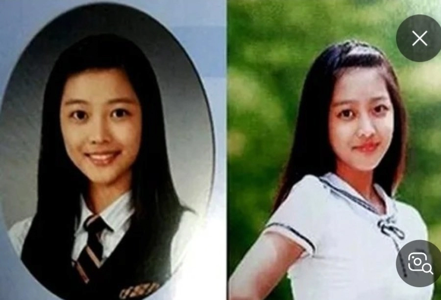 성형하고 싶었지만 아버지가 반대했다는 여자 연예인