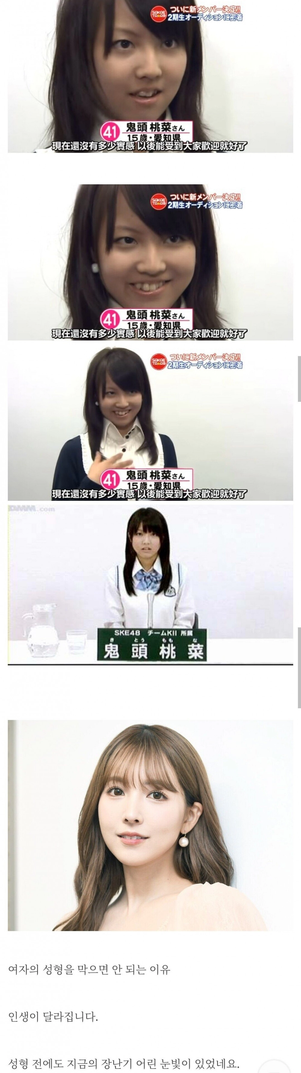 충격 미카미 유아 성형 전 & 후 얼굴