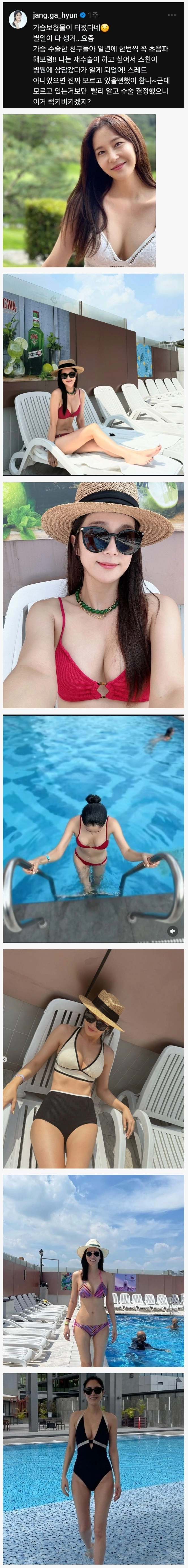 가슴 수술 노빠구 인증 여배우 비키니 직찍