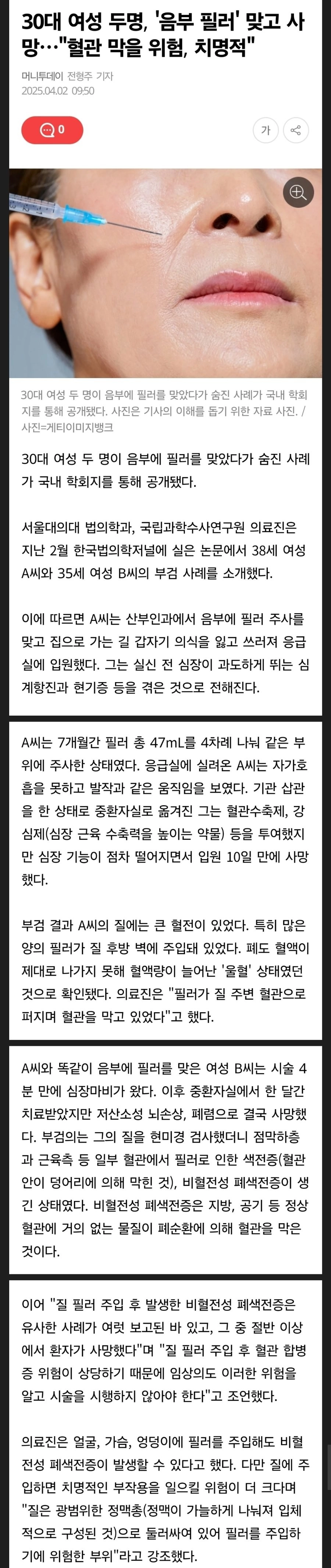 성형 시술이 목숨 앗았다 ‘음부 필러’ 맞은 여성 2명 사망