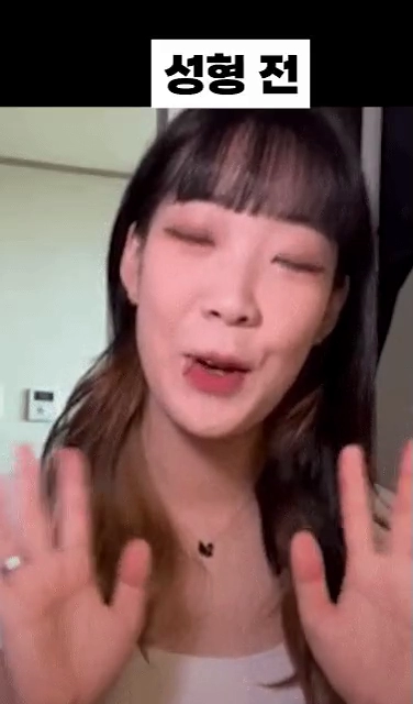 성형 전후 차이를 공개하는 유튜버