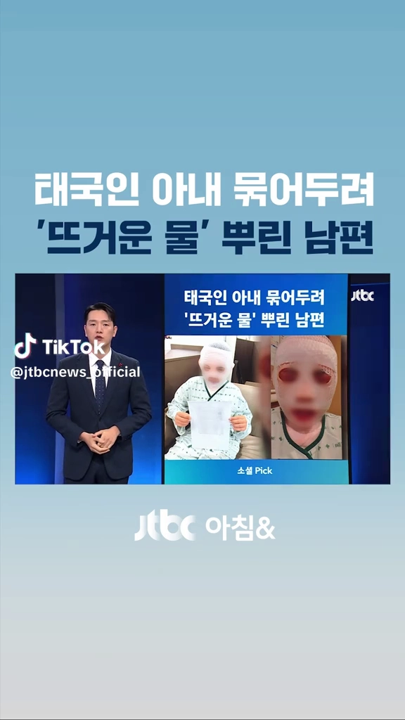 태국인아내 얼굴 뜨거운 물 뿌려...